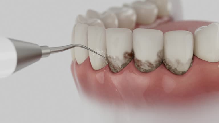 Reliable Dental Implants contractor in Wagener, SC by Smile Center Dentistry